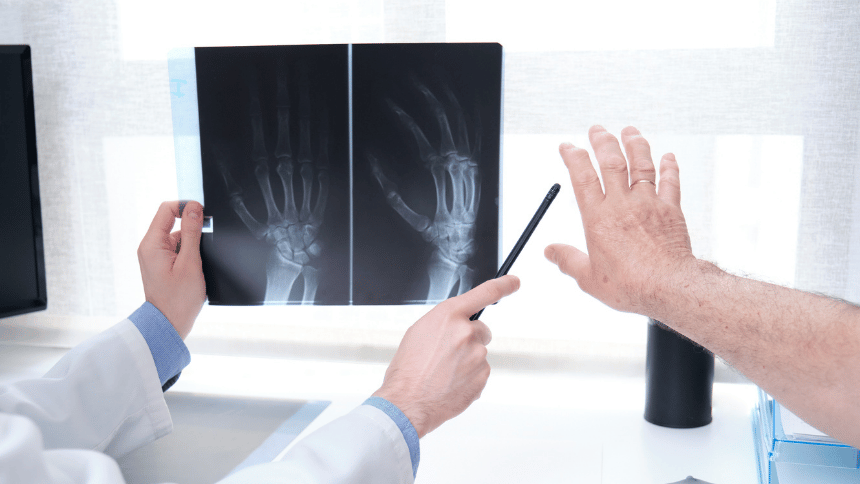 Bolest kloubů na rentgenu.