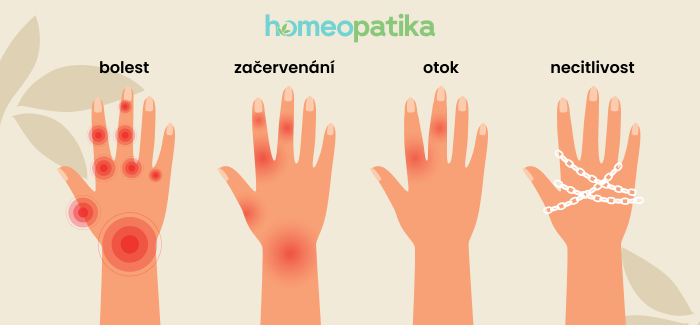 akutní vs. Chronický zánět