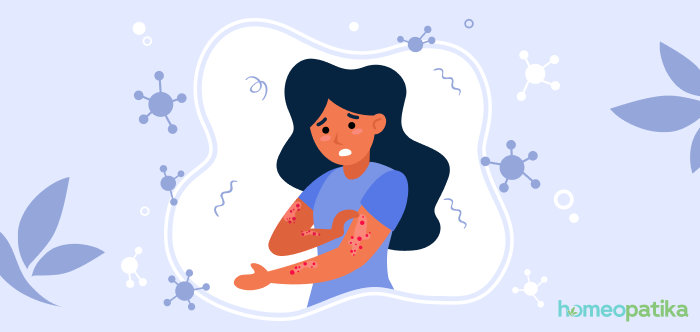  žena, která si škrábe svůj ekzém