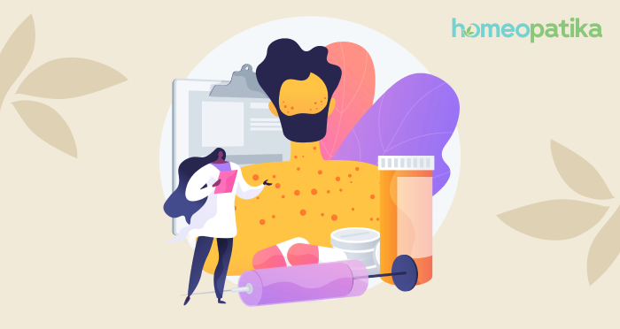  léčebné metody na lupénku