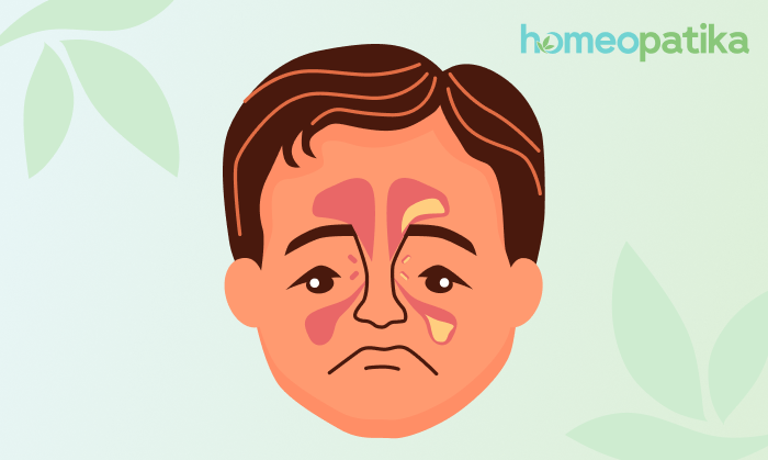  jak vypadají zanícené dutiny