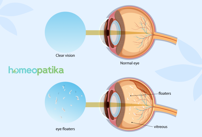  kdy navštívit lékaře