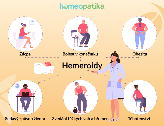  symptomy hemoroidů