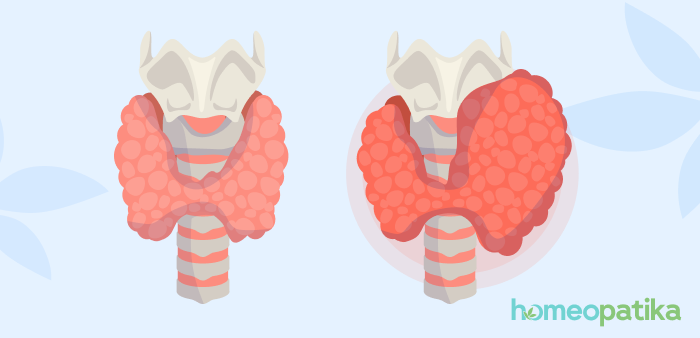 zdravá vs nezdravá štítná žláza