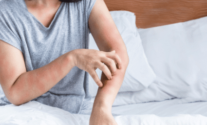 Drbající se žena v posteli kvůli alergii na roztoče.