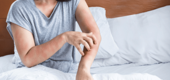 Drbající se žena v posteli kvůli alergii na roztoče.