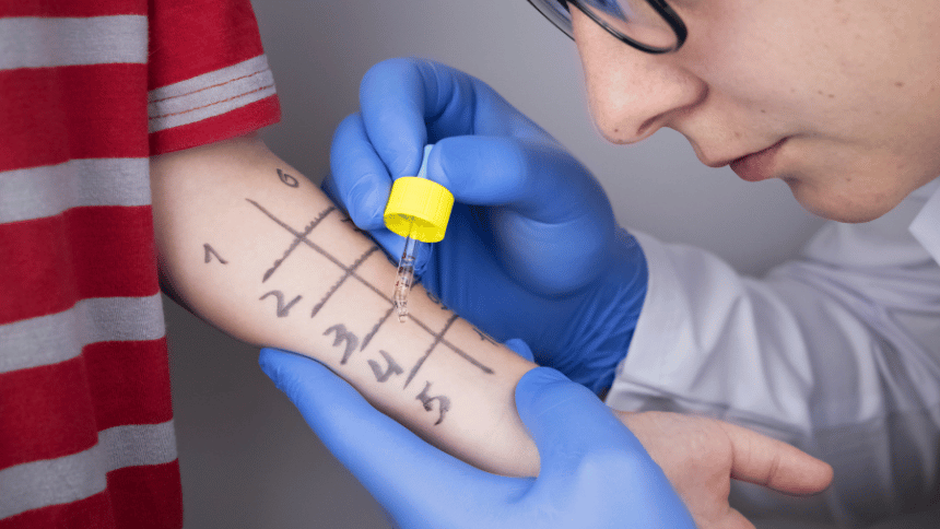 Vyšetření na alergii.