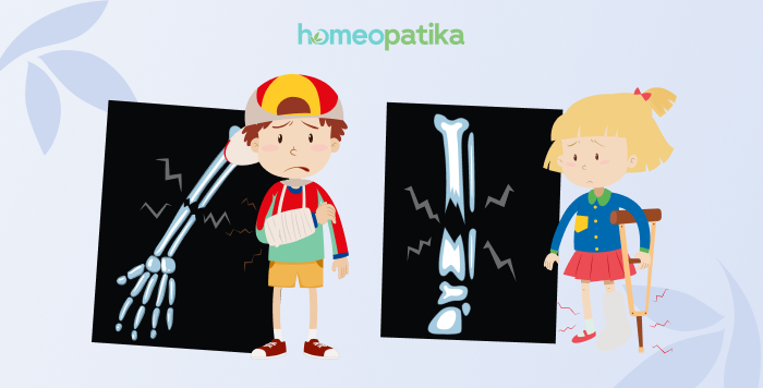  dítě se zlomeninou