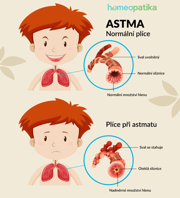  rozdíl mezi zdravými plícemi a astmatickými