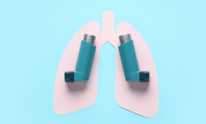 Astmatické plíce.