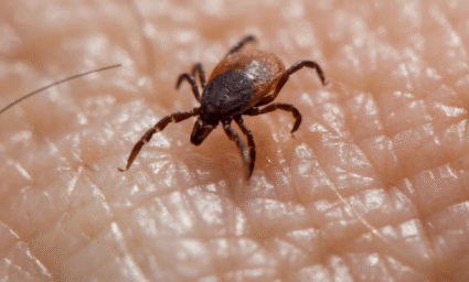 Klíště na kůži.