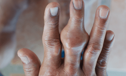 Dna v prostředníčku ruky.