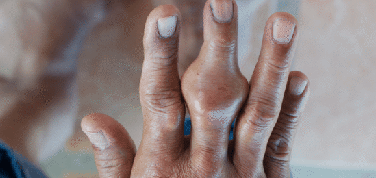 Dna v prostředníčku ruky.