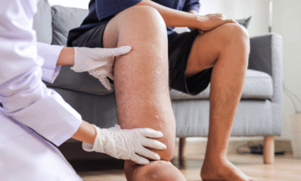 Silně oteklá noha.