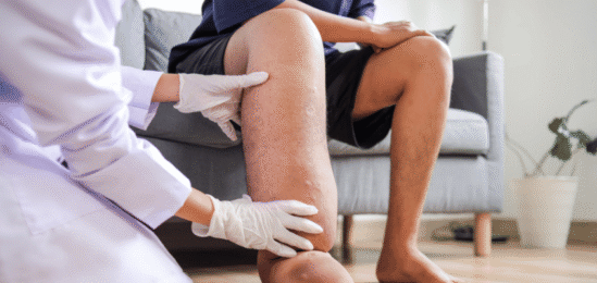 Silně oteklá noha.