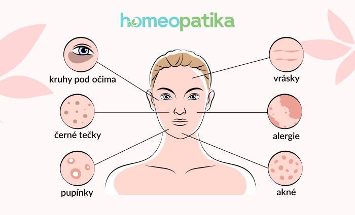  různé kožní problémy