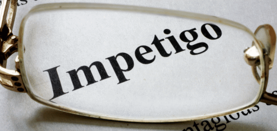 Slovo impetigo ve slovníku.