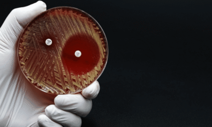 streptokok v petriho misce.