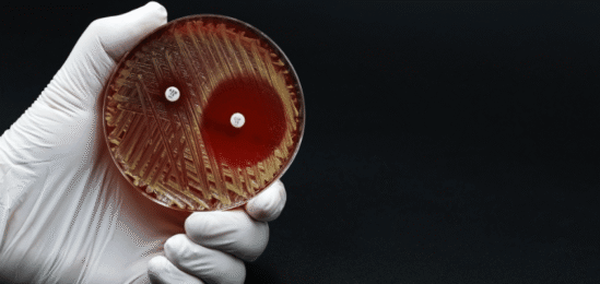 streptokok v petriho misce.