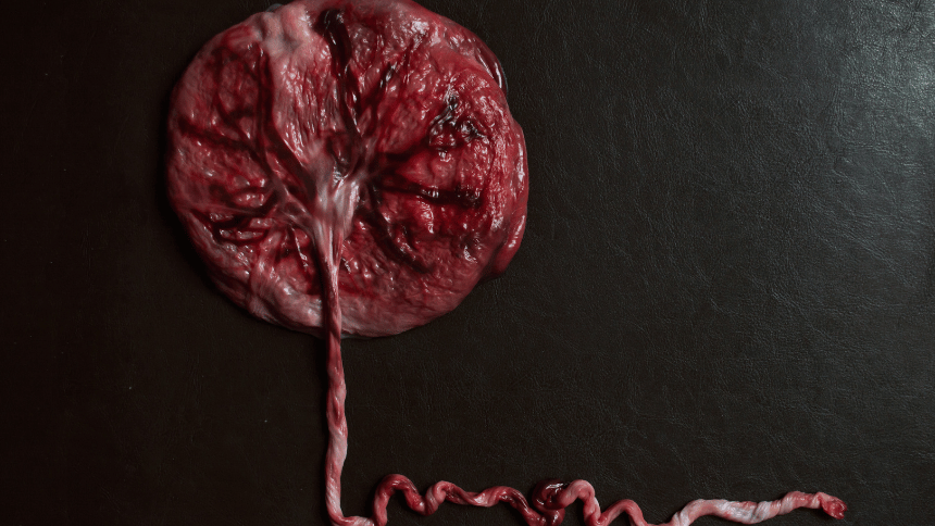 Organická placenta po porodu.